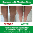 Sakerplus Cellulite-Massagegerät