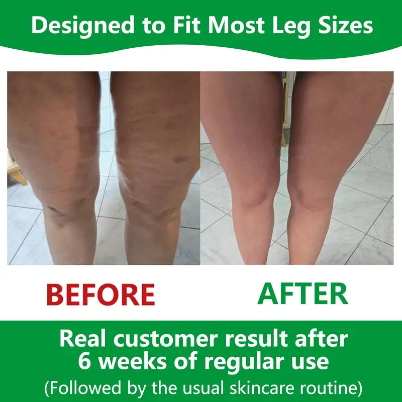 Sakerplus Cellulite-Massagegerät