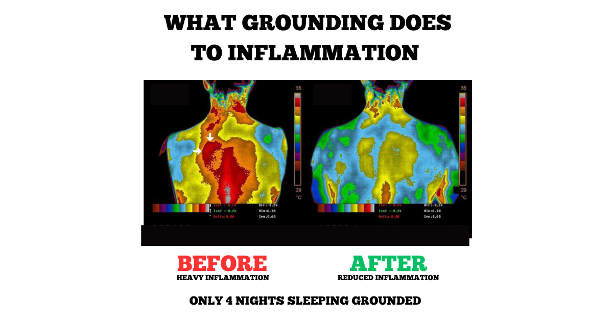 Earthing Grounding Bed Sleep Mat